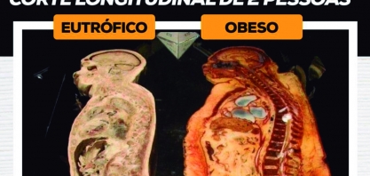 Obesidade não é saudável!
