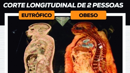 Obesidade não é saudável!
