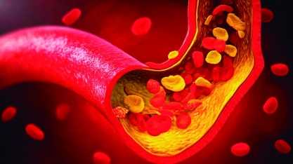 Mais da metade dos brasileiros não sabe qual a sua taxa de colesterol