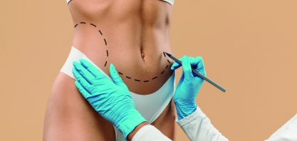 O fim da lipoaspiração?