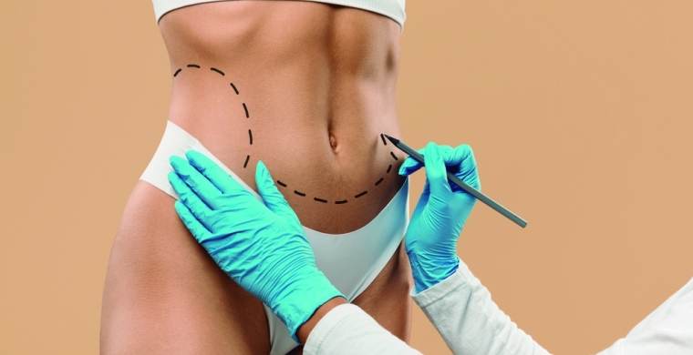 Sa&uacute;de: o fim da lipoaspira&ccedil;&atilde;o? Saiba mais na coluna do Dr. Jo&atilde;o Ferrari