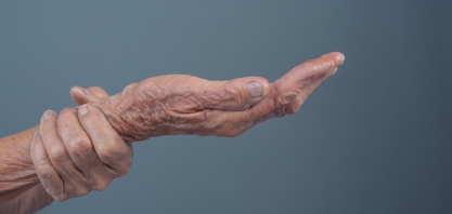 Nova terapia aprovada pela Anvisa reacende debate sobre tratamento do Parkinson avançado
