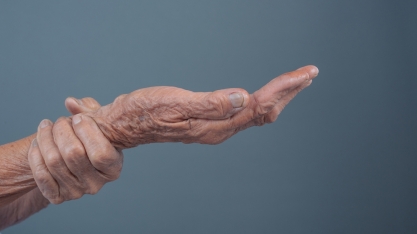 Nova terapia aprovada pela Anvisa reacende debate sobre tratamento do Parkinson avançado